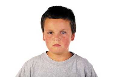 Heads up! Measles is making a comeback in Brooklyn