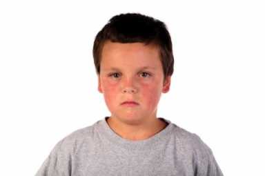 Brooklyn ground zero in measles outbreak