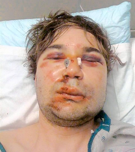Teens beat up Williamsburg man in gay hate crime