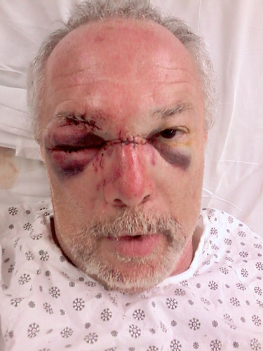 Zigun’s hurt — and he needs your help!