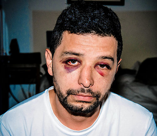 Williamsburger: I was the victim of an anti-gay beatdown steps from my front door