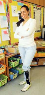 Colleagues step up for teacher who lost her leg