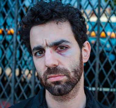 Low-level pol: I got a shiner protecting a damsel in distress