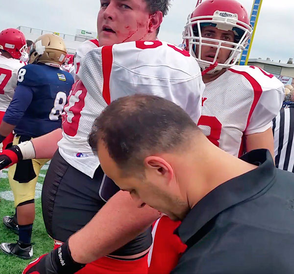 Blood sport! Cops, firefighters get into gory fight at charity football game