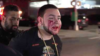 Man sues cop, city for Bed-Stuy beatdown caught on body cam