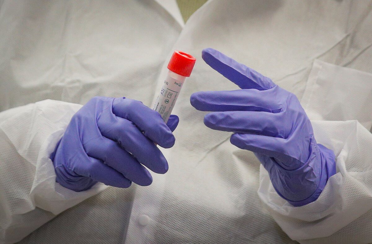 A scientist holds a sample during COVID-19  testing at New York City’s health department, during the outbreak of the coronavirus disease (COVID-19) in New York