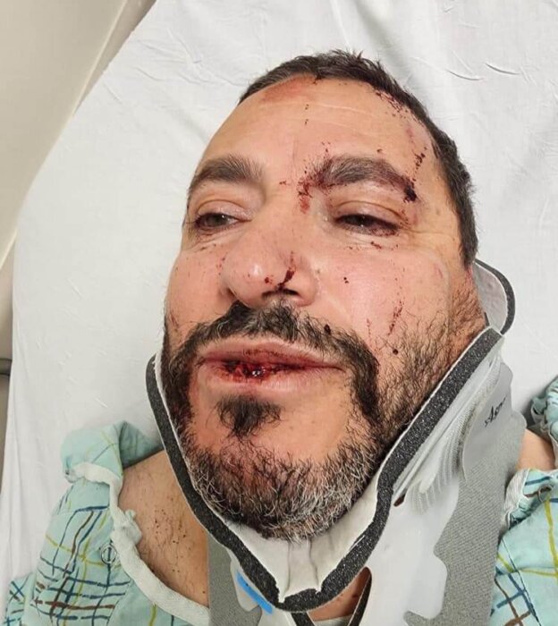 Jamal Sawaid was left bloodied and bruised after the April 15 attack.