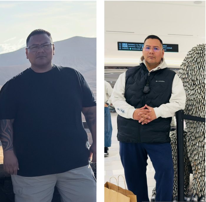 before and after weight loss